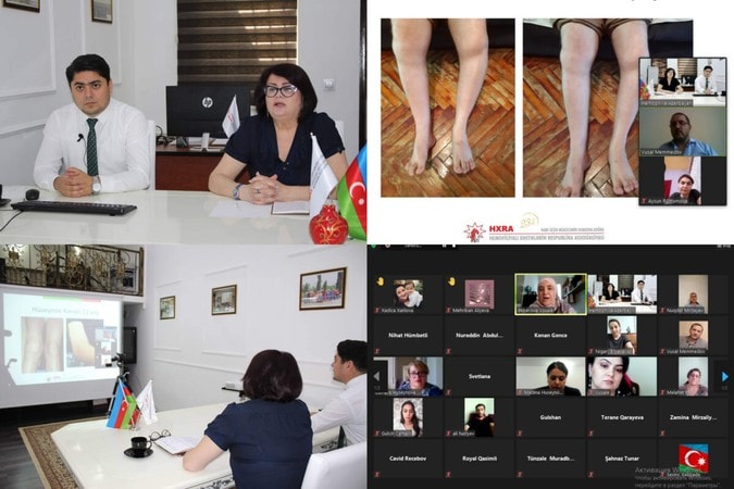 Hemofiliya Məktəbi çərçivəsində fizioterapiyaya dair təlim keçirildi